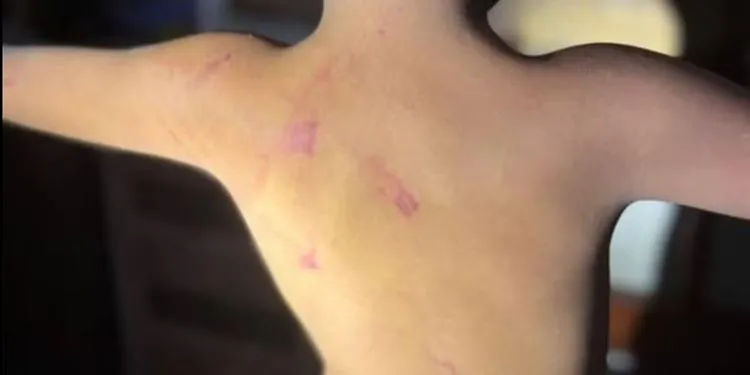 Mãe é presa por agredir três filhos com fio elétrico em Marituba; um deles bebê